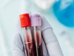 PMI Sukabumi Siap Bantu Kebutuhan Warga akan Plasma Konvalesen